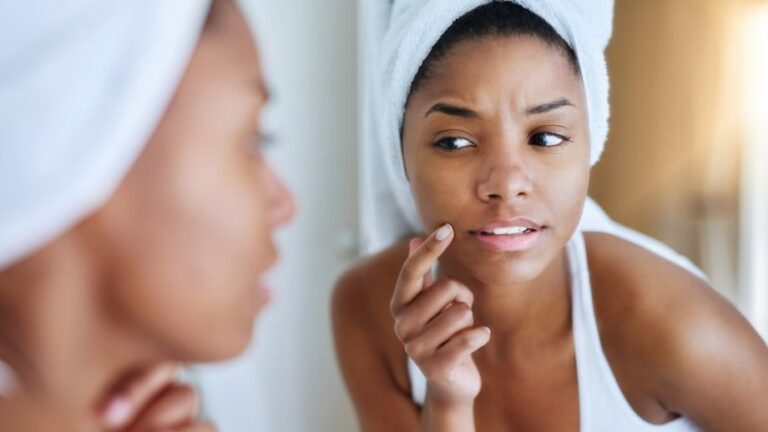 Surprising Things That Could Cause Your Skin to Break Out